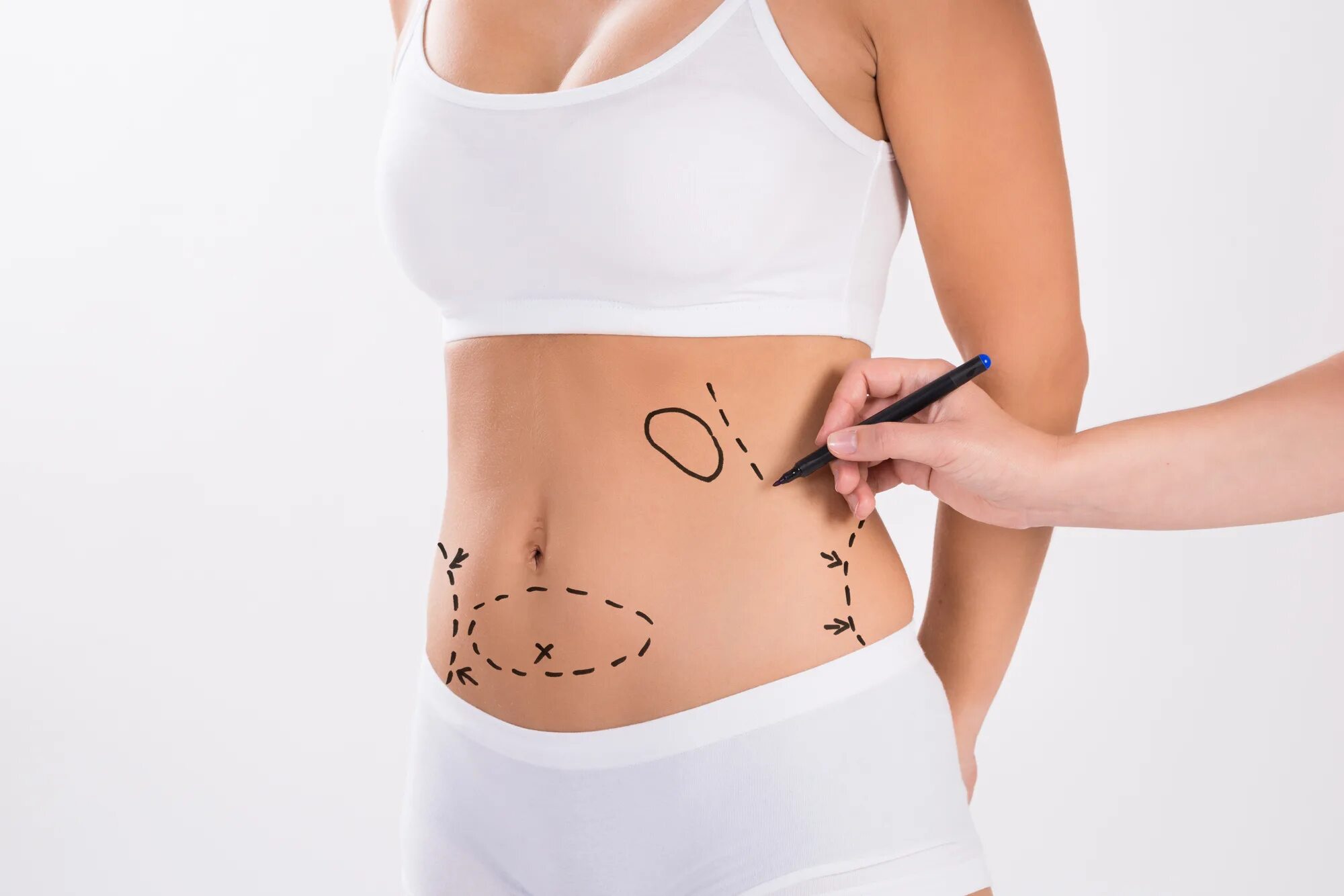 Пластическая хирургия бедер. Body surgery. Маммопластика операция. Body surgery. Пластическая операция абдоминопластика.