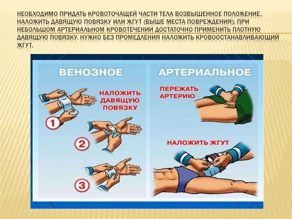 При сильном кровотечении нужно. Оказание первой помощи при кровотечении. Наложение повязки при венозном и артериальном кровотечении. Наложение жгута для остановки кровотечения. Наложение жгута и давящей повязки.