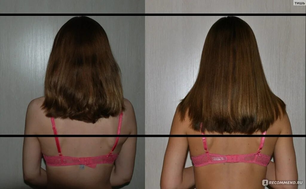 Для роста волос. Рост волос на голове. Массаж головы для роста волос до и после. Рост волос в месяц.