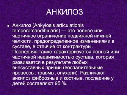 Анкилоз