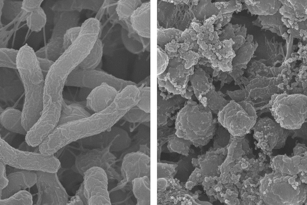 Shape-shifting agent targets harmful bacteria in the stomach Illinois