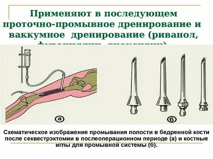 Полость применять