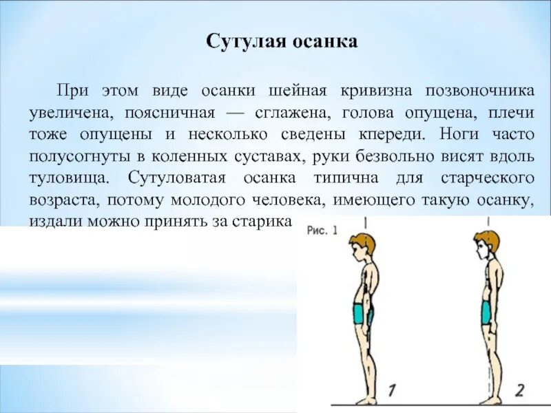 Под правильной осанкой понимается