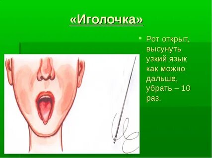 Иголочка текст