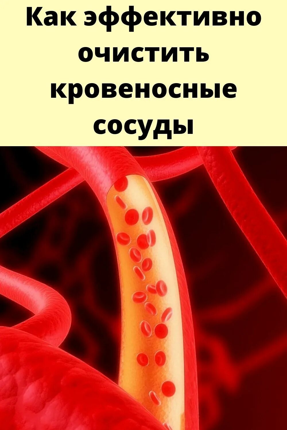 Прочистка сосудов. Очищение кровеносных сосудов. Очистить кровеносные сосуды. Средство для очистки сосудов кровеносных. Очищение кровеносных сосудов сердца.