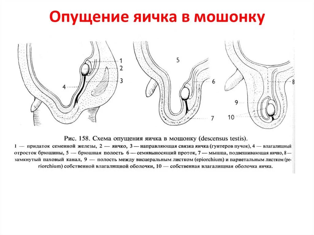 Процесс опускания яичка в мошонку. Опущение яичек у мальчиков схема. Не опускаются яички что делать