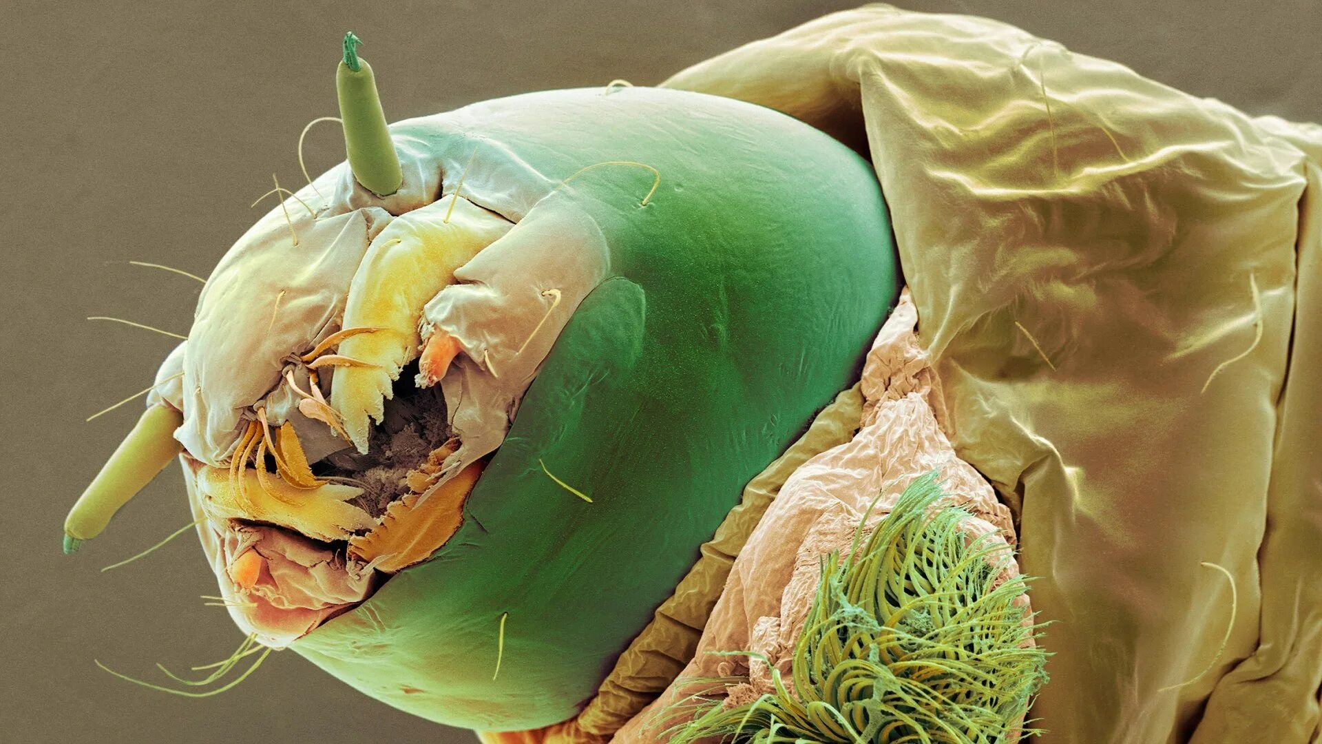 Бактерии на мухе. VBRH,S gjl vbrhjcrjg. Микробы фото. Микробы на теле человека.