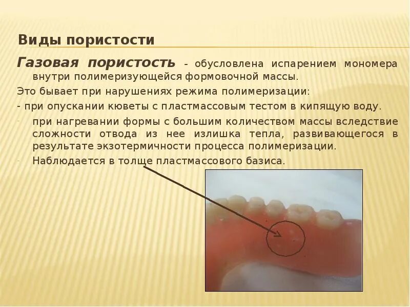 Режим полимеризации пластмассы. Газовая гранулярная пористость сжатия. методы полимеризации пластмасс в стоматологии. пористость пластмассы базиса протеза. газовая пористость пластмассы.