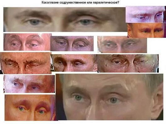 Как видит человек при косоглазии. Как видят мир косоглазые люди. Люди с косоглазием. Нарушение зрения косоглазие. Зрение косоглазие.