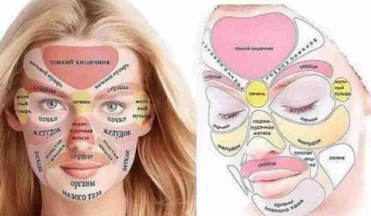 За какие органы отвечают прыщи на лице. Зоны прыщей на лице и органы. Прыщи на лице по зонам причины. Прыщи на лице по зонам и органам. Карта прыщей на лице.