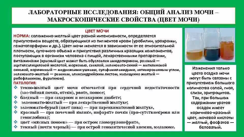 Плохо отходит моча у мужчины. Общий анализ мочи при заболеваниях почек. Общий анализ мочи при почечной колике. Моча при больных почках. Моча при почечной колике.