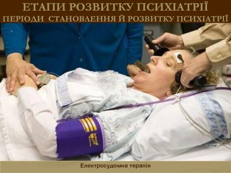 Лечение эст. Эст электросудорожная терапия. колетро судорожная терапия. электросудорожная терапия в психиатрии.