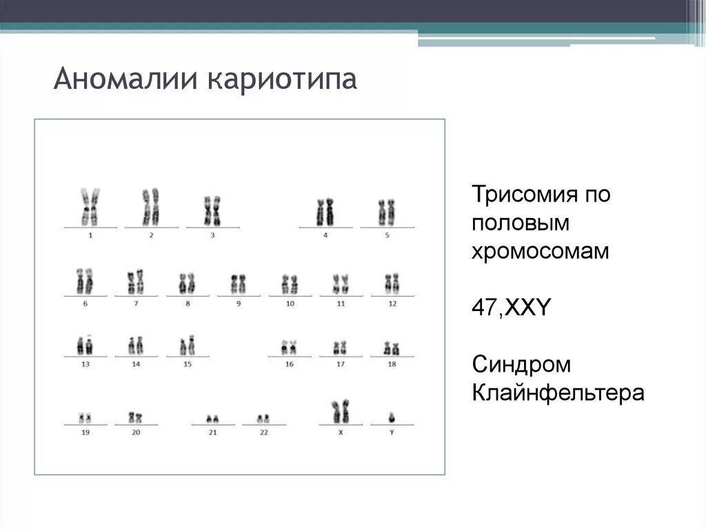 Отсутствие х хромосомы у мужчин. Нормальный кариотип человека 46 хромосом. Патологии кариотипа. Синдром Клайнфельтера трисомия. Таблица хромосомные заболевания кариотип.