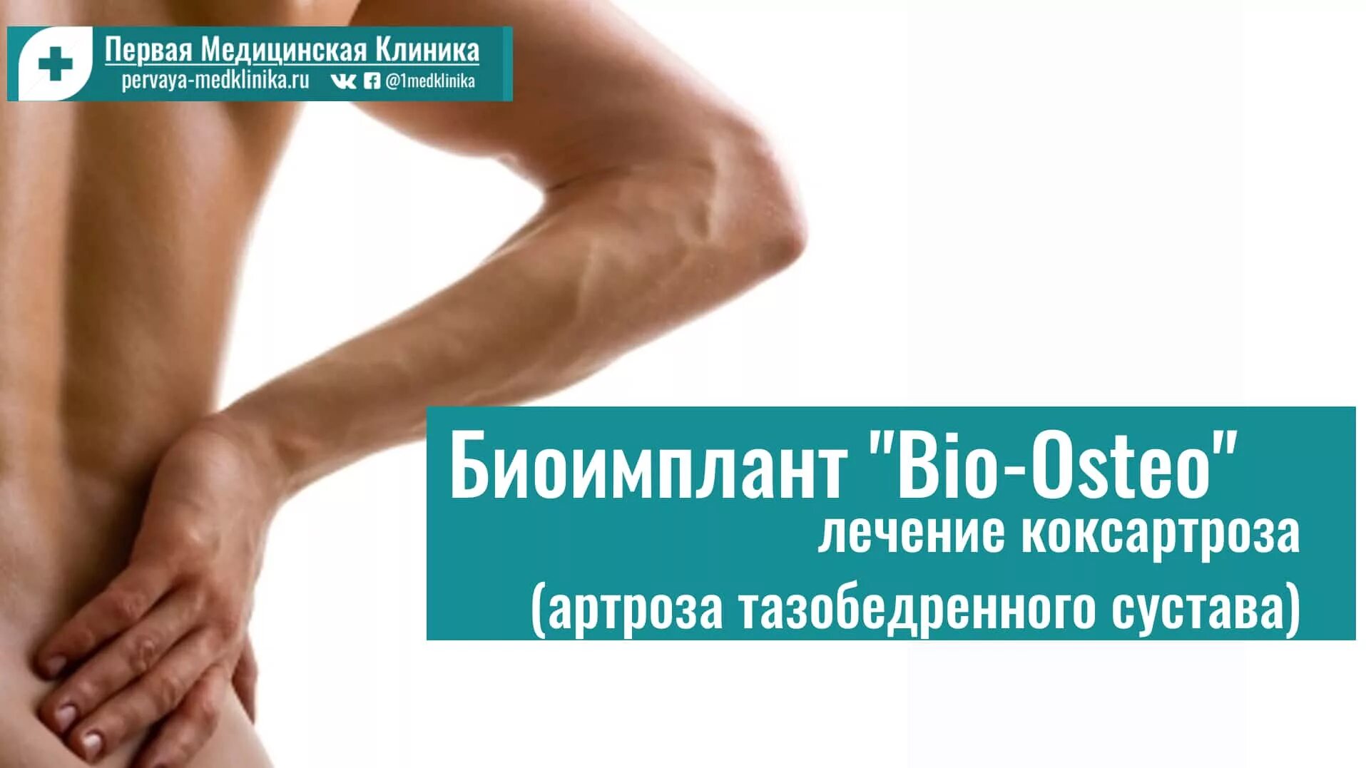 Биоимплант суставов спб. Биоимплант Bio-Osteo коленного сустава. Био Остео тазобедренного сустава. Биоимплант тазобедренного сустава.