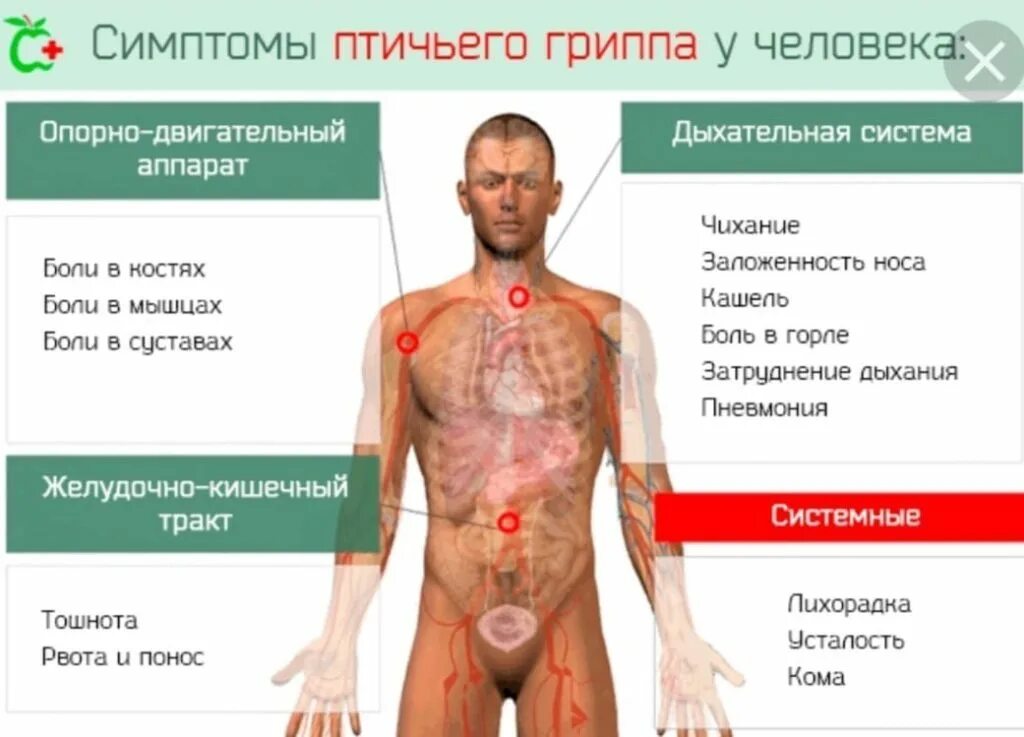 Вирус зима 2025 симптомы. Заразен ли птичий грипп для людей. птичий грипп симптомы у людей симптомы. признаки птичьего гриппа у человека. птичийгрип на человеке.