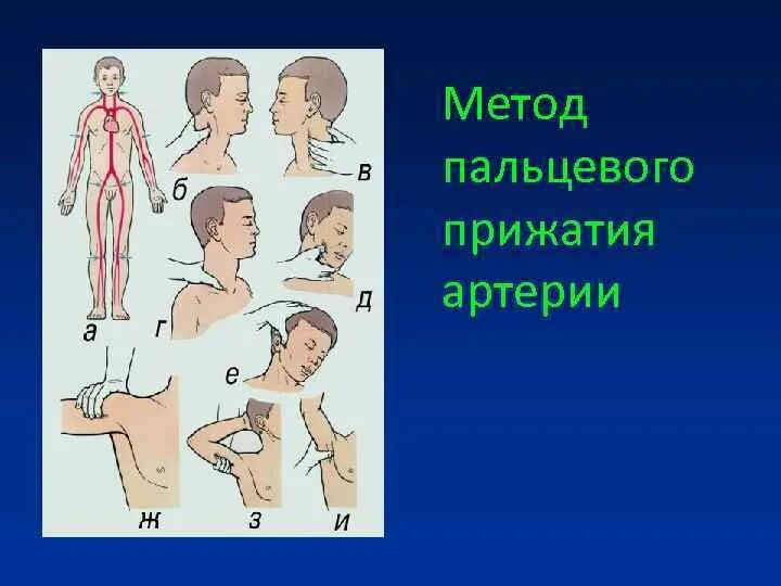 Пальцевое прижатие артерий осуществляется. Остановка кровотечения пальцевое прижатие артерий алгоритм. метод пальцевого прижатия артерий. методика пальцевого прижатия сосуда. способ пальцевого прижатия артерии.