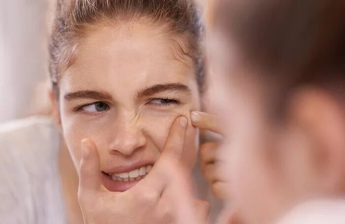 Pimple Man Images - Browse 15,228 Stock Photos, Vectors, and Video Adobe Stock