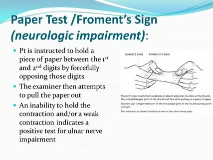 Sign test