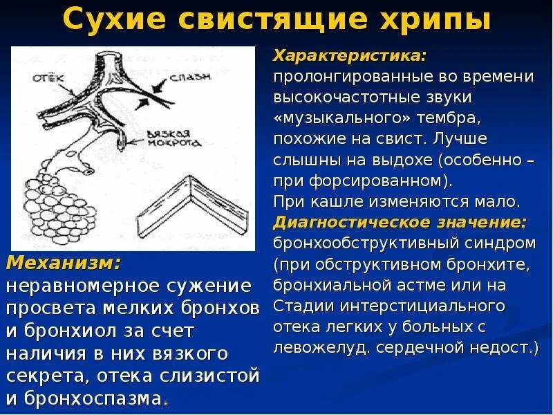 Свист при выдохе в лежачем положении