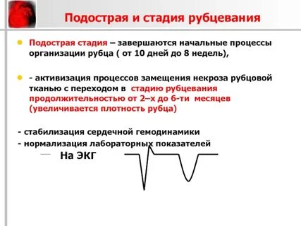 8 инфарктов