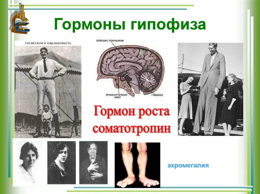 Гиперфункция гормонов гипофиза. Гипофиз влияние на рост и развитие. Гипофиз и рост человека. Соматотропный гормон гиперфункция гипофункция. Деятельность половых желез регулирует гормон гипофиза.