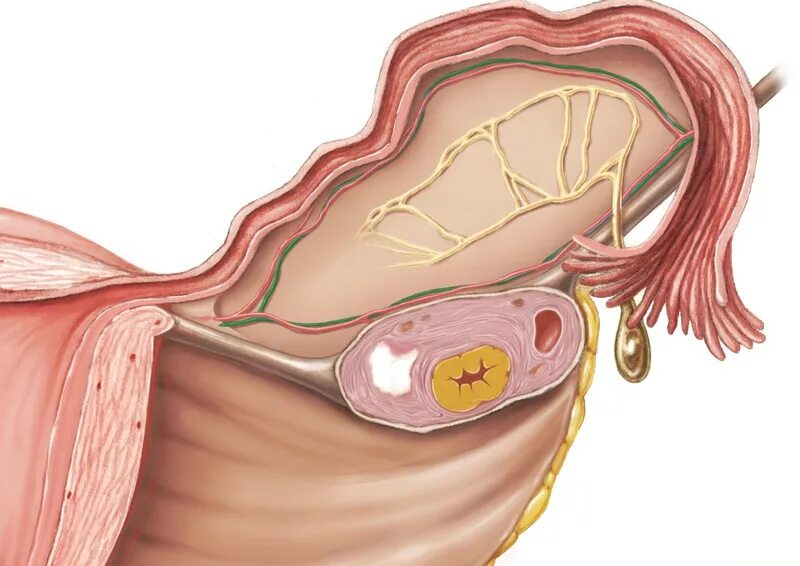 Взаимосвязь яичника. Киста женских яичников.