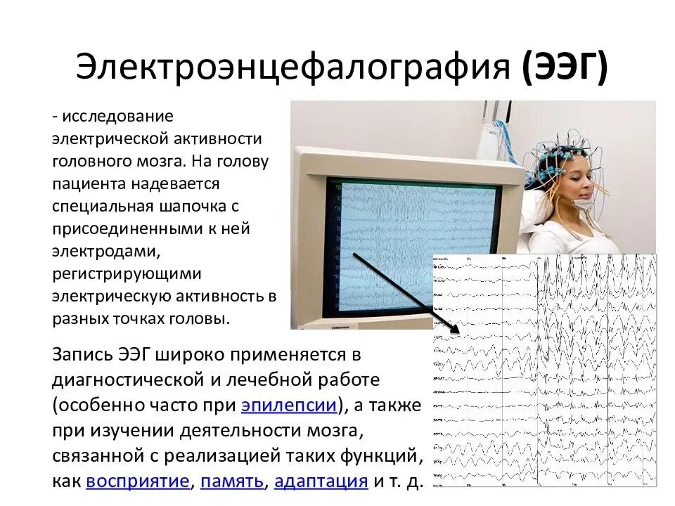 Для чего делают ээг. ЭЭГ метод исследования. Электроэнцефалография (ЭЭГ) метод. Принцип исследования ЭЭГ. Электроэнцефалографическое исследование (ЭЭГ.