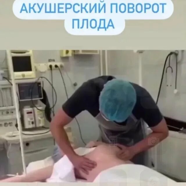 Тазовые роды видео
