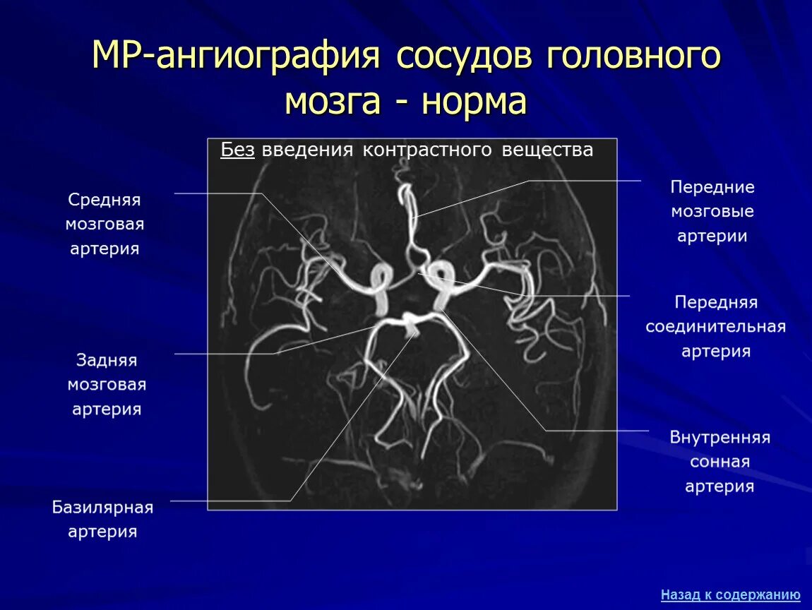 Сосуды головного мозга норма