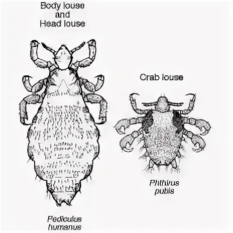 К какому классу относится вошь. Платяная вошь (pediculus humanus corporis). платяная вошь самец. платяная вошь по латыни.