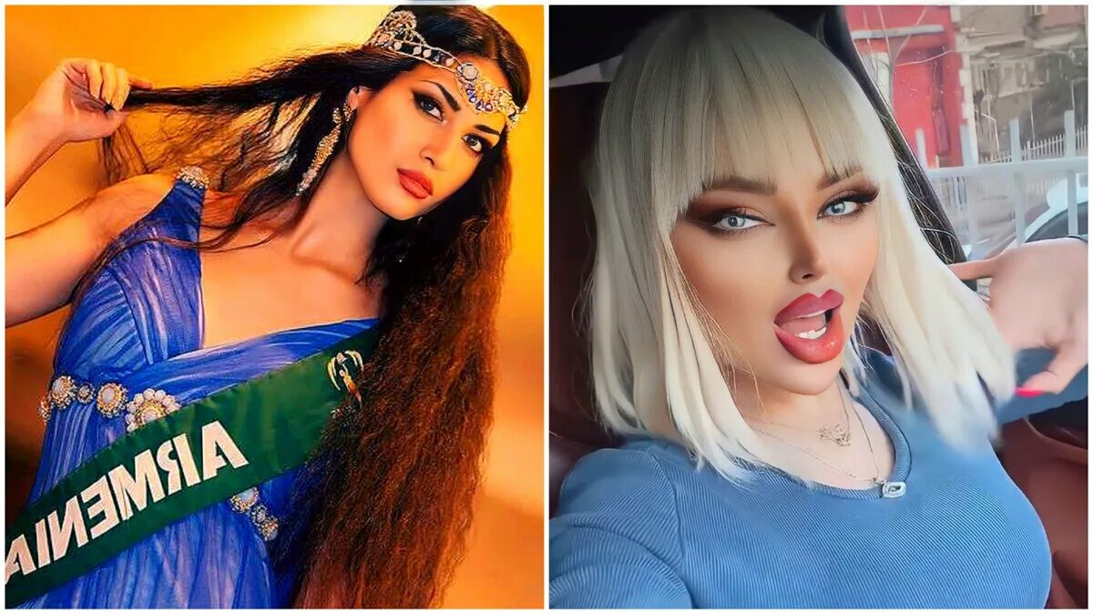 Before and after plastic surgery: Foreign media outlets think Armenian model Lil