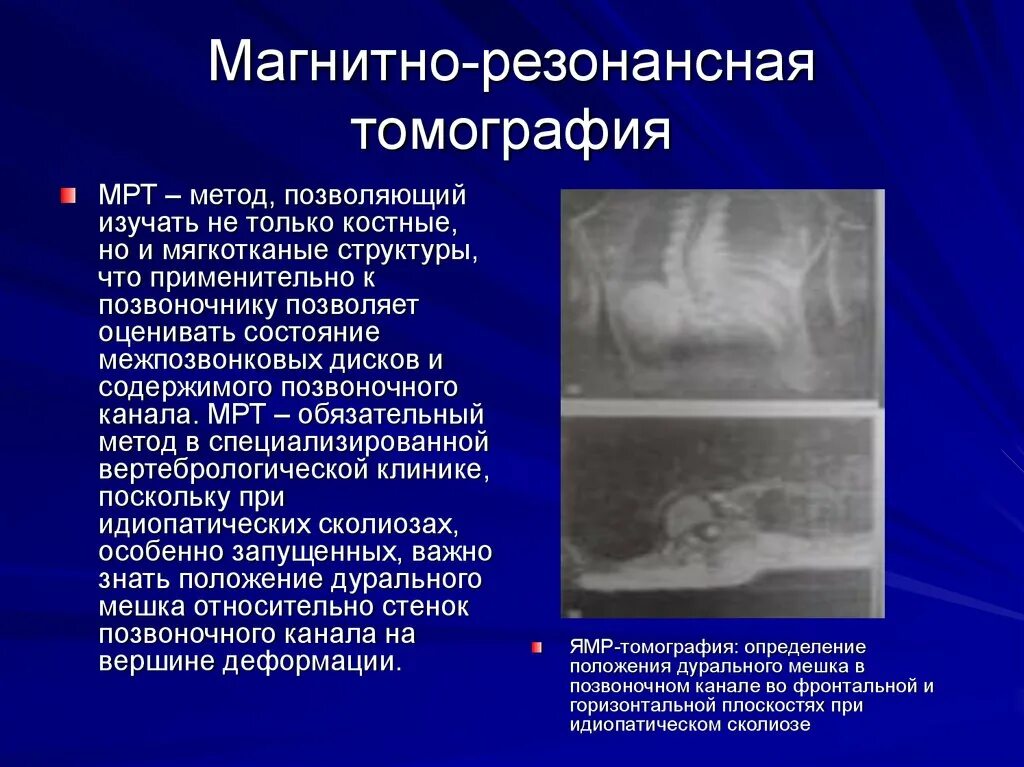 Мрт при температуре можно. Магнитно-резонансная томография. магнитно резонансная томография презентация. мрт методы исследования. магнитно-резонансная томография метод исследования.