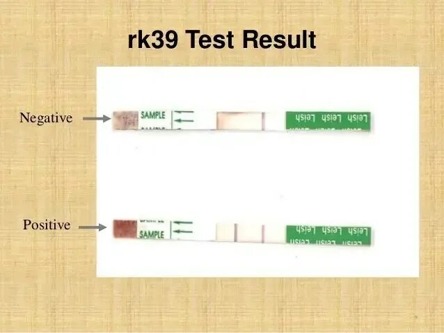Тест на антиген фото. Тест на антиген сделать самому. Тест на коронавирус Южная Корея. 95% Negative 5 % positive Test. 312 39