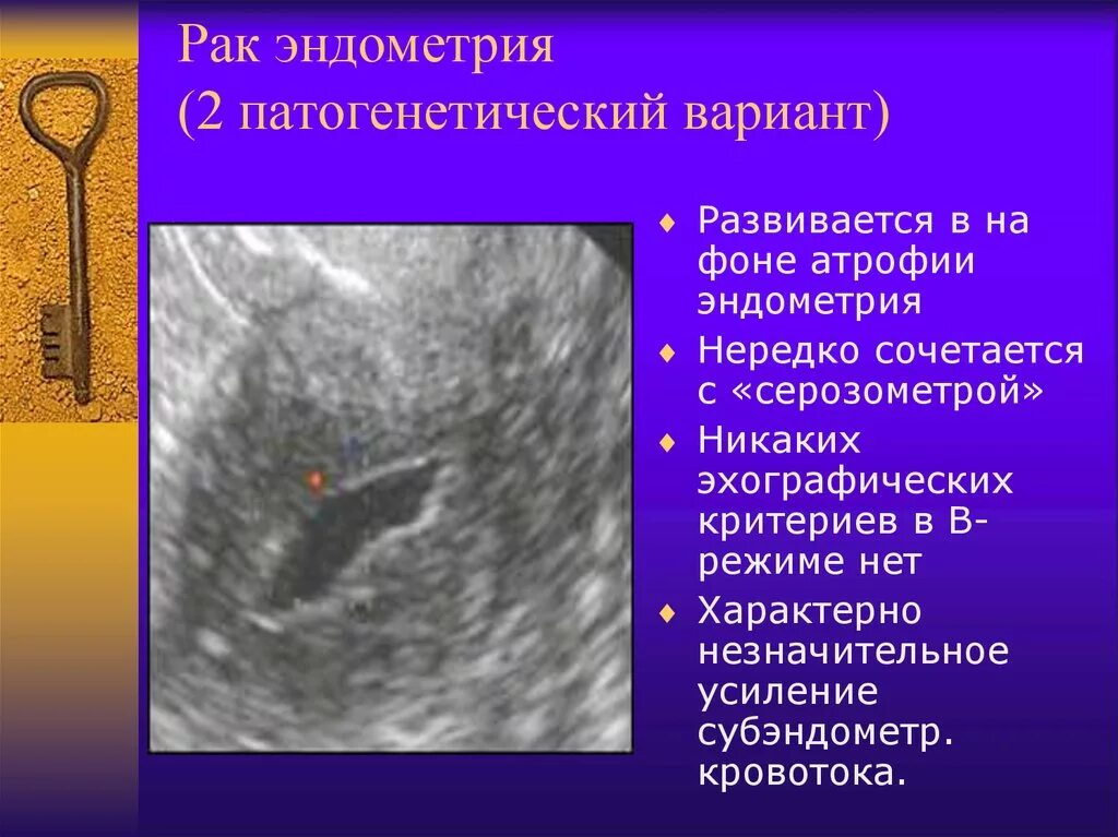 Смешанная эндометрия. Гиперплазия эндометрия полипоз эндометрия).. Эндометриальный аденокарцинома. Злокачественные опухоли эндометрия. Аденокарцинома эндометрия УЗИ.