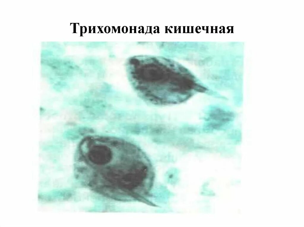Трихомонада строение. Влагалищная трихомонада. кишечная трихомонада рисунок. морфология влагалищной трихомонады.