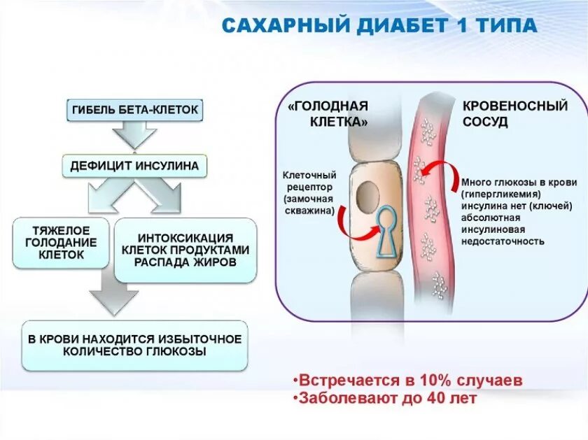 Сахарный диабет 1го и 2го типа. Сахарный диабет 1 типа иммунология. Диабет 1 типа механизм. Клинические признаки сахарного диабета 2 типа. Сахарный диабет 1 типа инфографика.