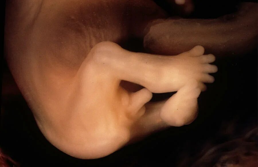11 Weeks Pregnant: Symptoms, Belly, Baby Size & More 11 weeks pregnant, Pregnanc