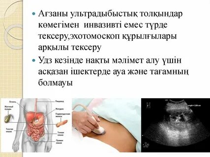 Моншадағы төсекте жыныстық қатынас