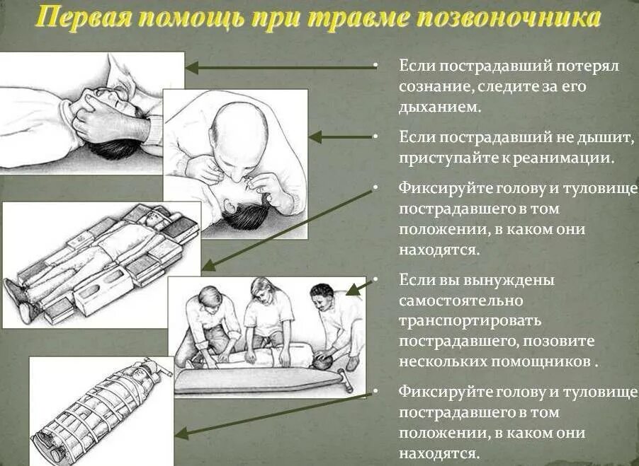 Первая помощь при травме спины. Алгоритм оказания помощи при травме позвоночника. пмп при травме позвоночника. перелом позвоночника пмп. первая медицинская помощь при переломе позвоночника.