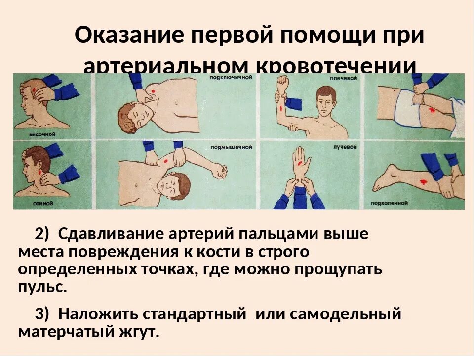 Кровотечение из предплечья помощь. Артериальное кровотечение пмп. при оказании первой помощи при артериальном кровотечении необходимо. оказание первой помощи при артериальном и венозном кровотечении. алгоритм оказания помощи при артериальном кровотечении.