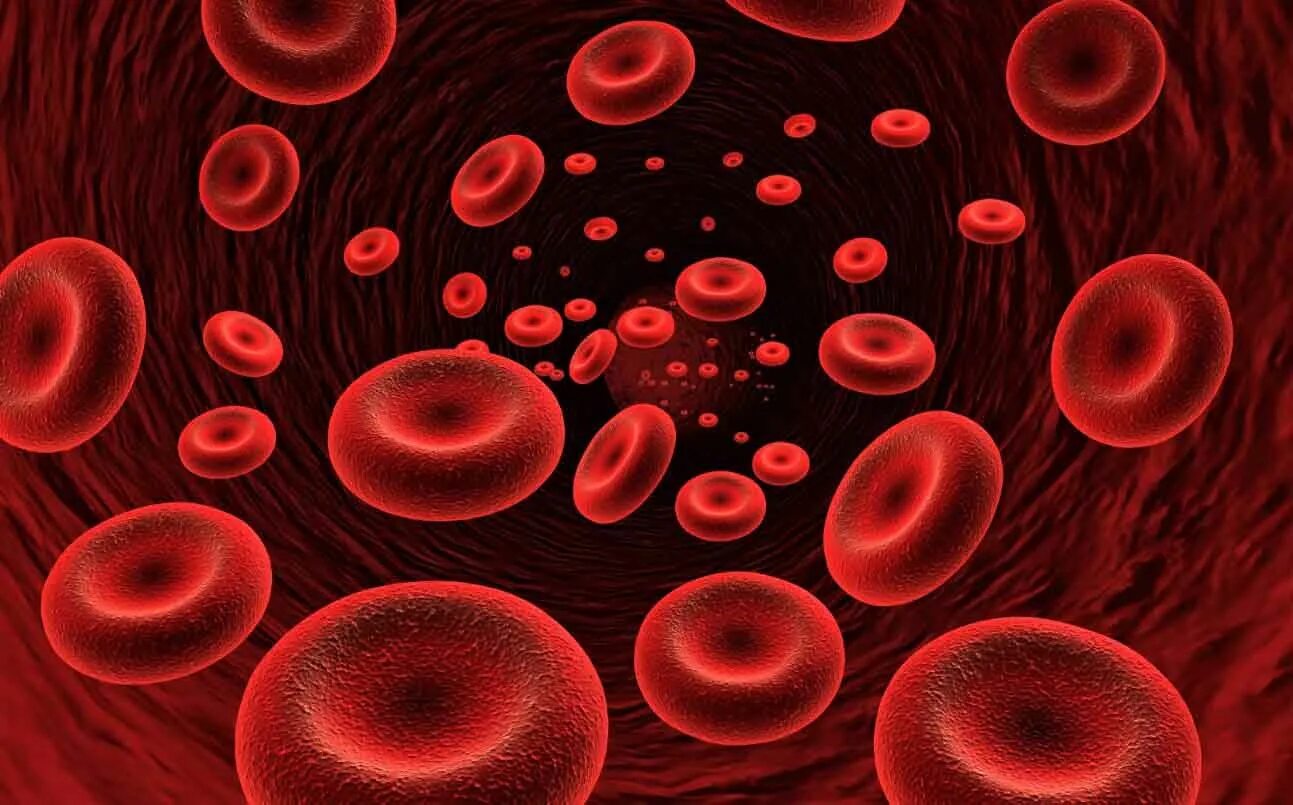 Гемоглобин при заболеваниях крови. Жда эритроциты. Железодефицитная анемия клетки крови. Эритроциты в крови анемия. Анемия железодефицитная эритроциты в крови.