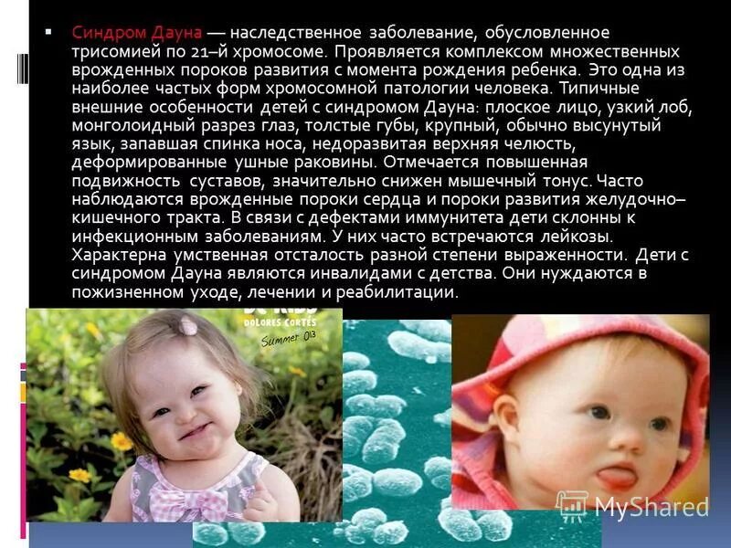 Синдром дауна характеристика заболевания фото и описание. Синдром дауна характеристика. Синдром дауна у детей презентация. Мозаичный синдром дауна. Синдром дауна характеристика заболевания фото и описание.