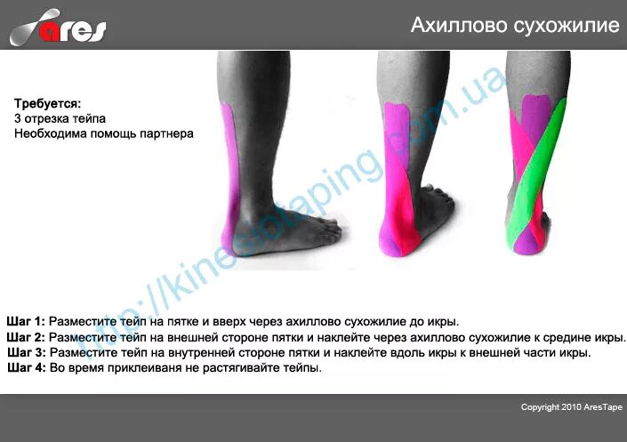 Наложение тейпа на ахиллово сухожилие. Тендинит ахиллова сухожилия тейпирование. Тейпирование ахиллова сухожилия. Тейпирование ахиллова сухожилия. Кинезио тейпирование ахилла.