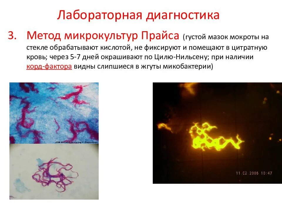 Метод прайса. Корд-фактор микобактерий туберкулеза. метод микрокультур прайса туберкулез. лабораторная диагностика методы выявления микобактерии туберкулеза. mycobacterium tuberculosis культивирование.