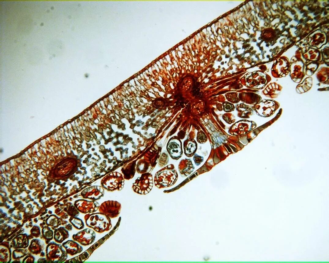 Поперечный разрез соруса папоротника. Поперечный срез соруса папоротника. Поперечный срез соруса папоротника. Щитовник мужской сорусы. Строение соруса папоротника под микроскопом.