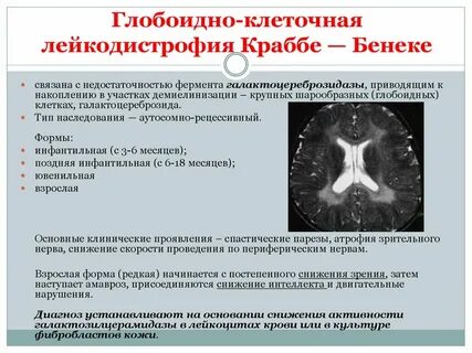 Болезнь краббе простыми словами