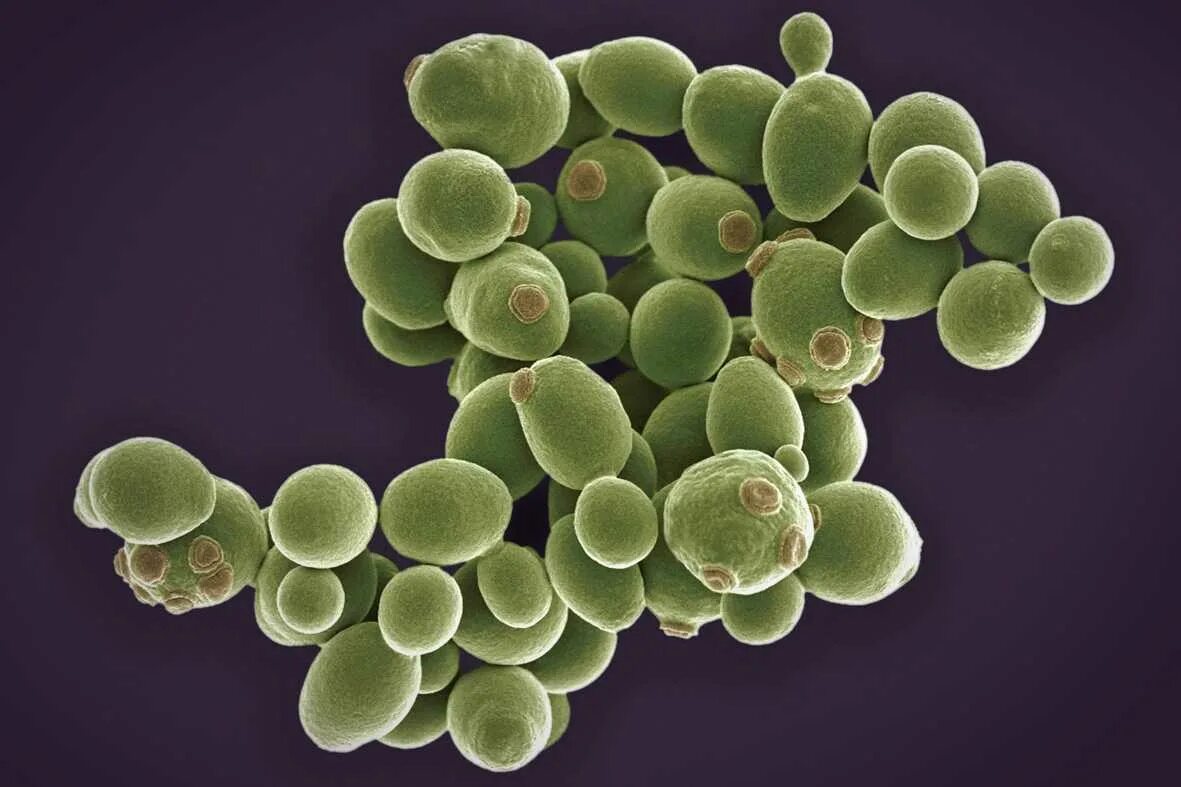 Одноклеточные грибы дрожжи. Дрожжевые микроорганизмы. Saccharomyces vini под микроскопом. Дрожжевые микроорганизмы. Saccharomyces cerevisiae колонии.