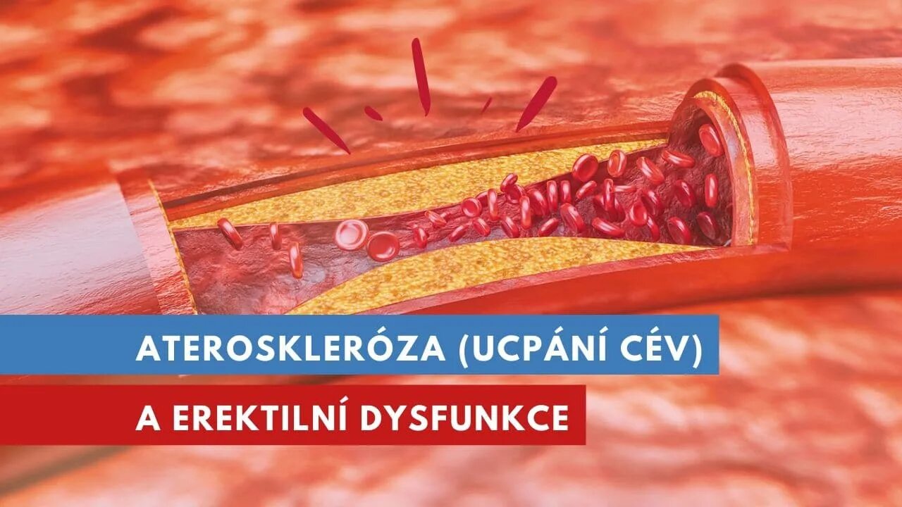 Санатории атеросклероз. Методы диагностики атеросклероза. лабораторная диагностика атеросклероза. инструментальная диагностика атеросклероза.