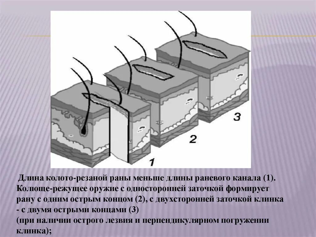 Длина кололи