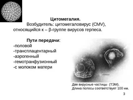 Цитомегалия